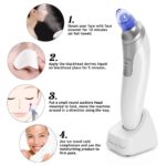 Ensemble de 4 types de machines esthétiques, épurateur de peau à vibrations ultrasoniques, dissolvant de points noirs, EMS RF, masseur facial, pelle de cavitation propre, Peeling, Lifting du visage – Image 3