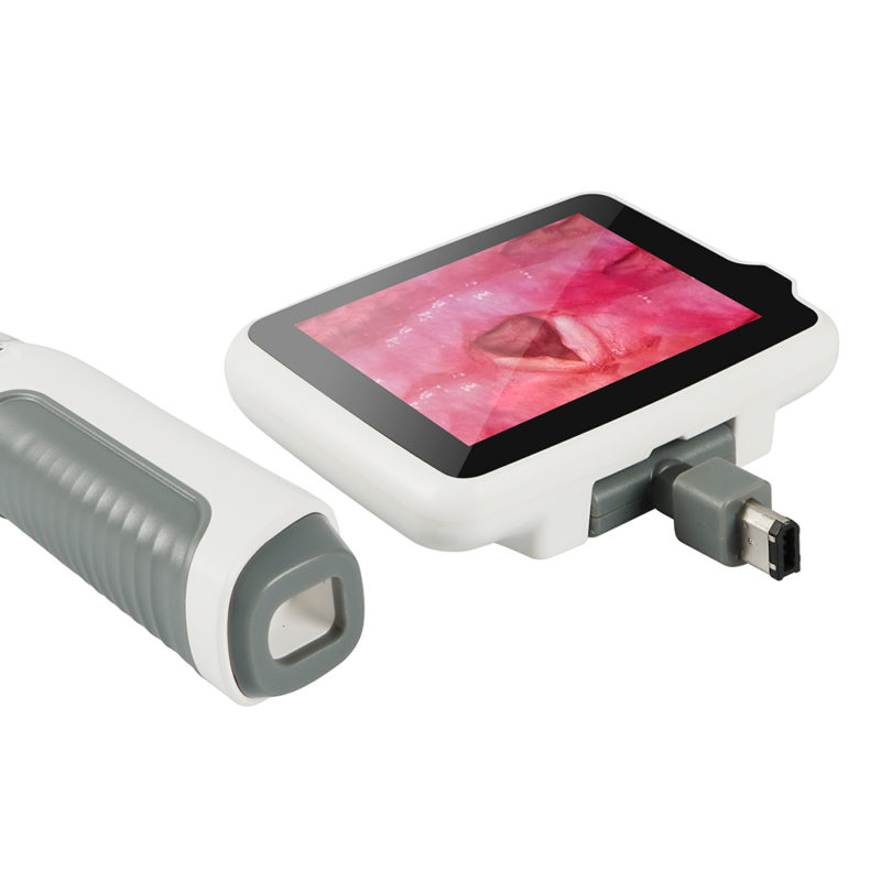 Laryngoscope vidéo numérique réutilisable, écran tactile 3.5 pouces, pour professionnel – Image 5