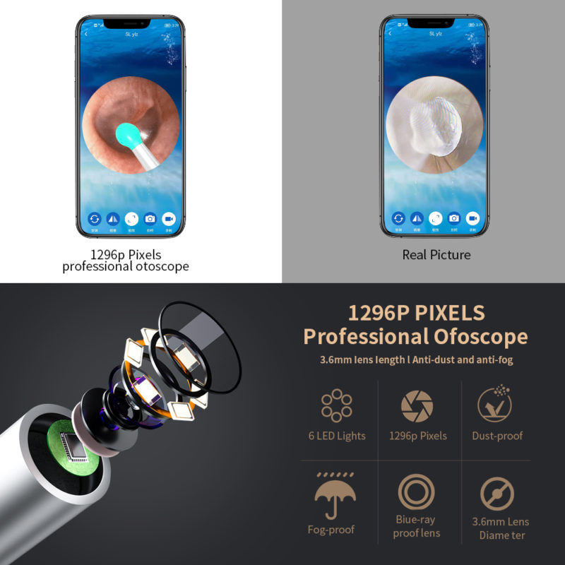 Kit de nettoyage des oreilles, élimination de la cire, sans fil, avec caméra et lumière LED – Image 4