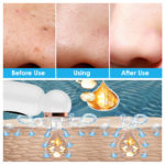 Aspirateur électrique des points noirs, nettoyeur de pores, charge USB – Image 3