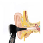 Otoscope LED professionnel, diagnostic d'oreille – Image 3