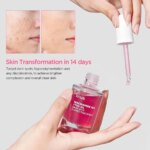 Lot de 3 sérums Anua niacinamide 10% + acide tranexamique 4%, anti-taches et éclat du teint – Image 3