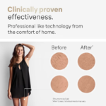 Appareil d’épilation laser IPL 999'999 flashs, Épilation définitive, sans douleur, 5 niveaux, écran LCD – Image 4